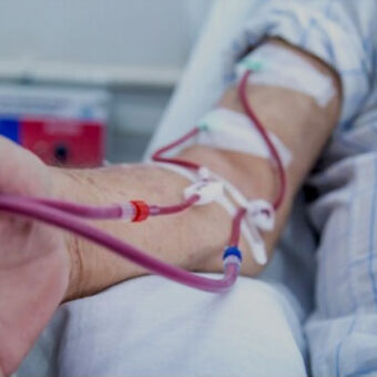 Chronic Kidney Renal Disease