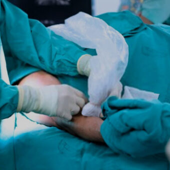 Complex Venous Surgery & Intravascular Ultrasound