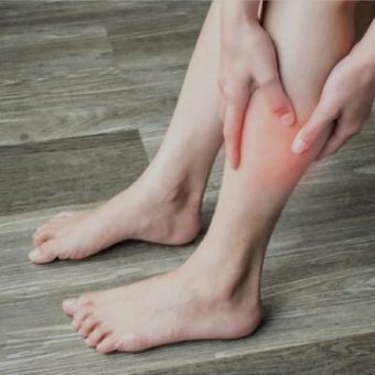 Peripheral Arterial Vascular Disease