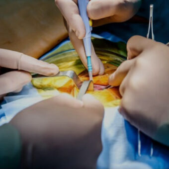 Spinal Access Surgery
