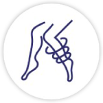 varicose veins