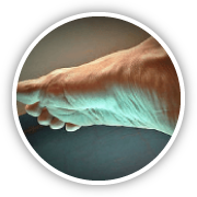 chronic complex wound care